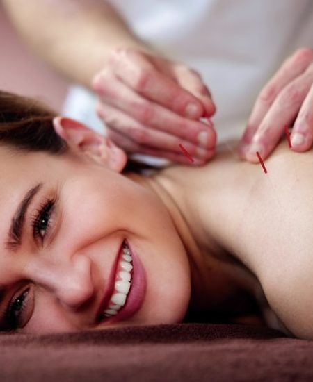 Dry,Needle,Acupuncture,Treatment.,Female,Medical,Spa,Therapy Dry,Needle,Acupuncture,Treatment.,Female,Medical,Spa,Therapy